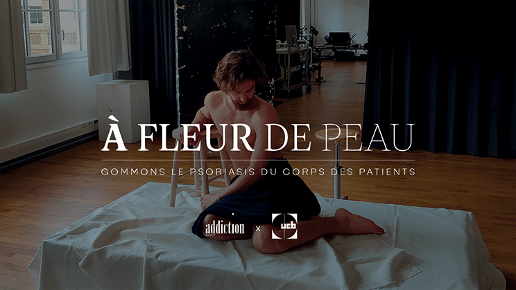 UCB A Fleur de Peau